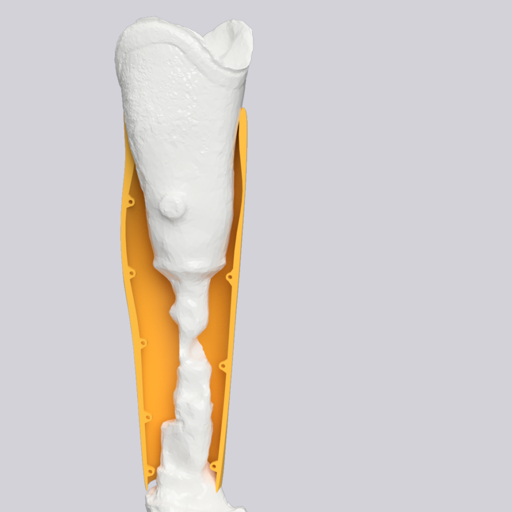 Druch 3D-Scan und 3D-Druck hergestelltes Prothesencover Professionelle Dienstleistungen